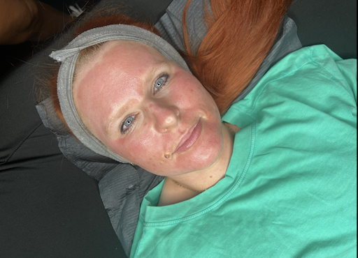 facial chemical peel-Eastmark-AZ